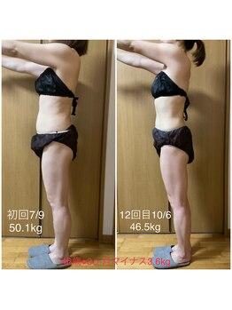 フィカス(FICUS)/スタイル維持、メンテナンスにも