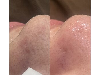 アトリエ ハルミナ(atelier harumina)/透明感♪トラブル知らずの土台を