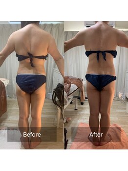 キアラ(Chiara)/痩身・ビフォーアフター