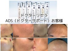 サロン エム(Salon M)の雰囲気（ドクターリセラADSシリーズや臍帯由来エクソソームが肌を変える!）