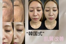 エーエスビューティーサロン(AS Beautysalon)