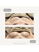 フルアナ(Hu ruana)/バストアップ/バストケア