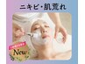 【ニキビ・肌荒れ】お悩み別フェイシャルコース♪