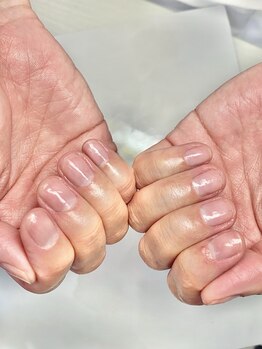 名古屋巻き爪専門Proの写真/【深爪育成/自爪育成】諦めていた爪も美しく！深爪・ちび爪・噛み爪を自爪育成で隠す爪から魅せる爪へ☆