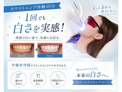 ホワイトニングショップ 各務原店の写真