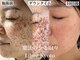 エステティック リベル キョウト 京都駅前店(Esthetic Liber Kyoto)の写真