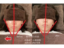 整体サロン宇宙/☆本格あご・小顔矯正☆