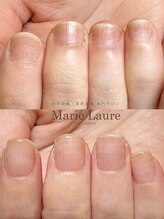 マリーロール 淀屋橋本店(Marie Laure)/自爪育成/深爪矯正/ネイルケア
