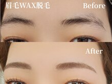 ウミカ(umica)/ムダ毛スッキリ垢抜け眉☆