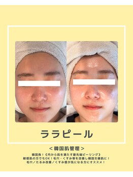 ソワナ(soina)/【神楽坂駅/フェイシャル/毛穴】