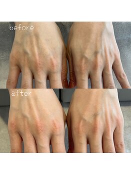 シャルム ド ネイルズ(Charm de nails)/