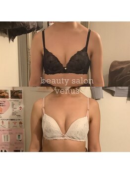 ヴィーナス(Venus)/バストアップで二の腕もスッキリ