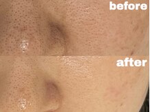 サゥオルサロン(sawalsalon)の雰囲気（最新ピーリング”セラピール”で叶う艶肌*）