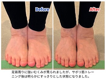 ラシュシュ/ビフォーアフター