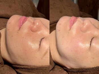 ルーナジェーナ(Luna llena)/池袋　エステ　ルーナジェーナ