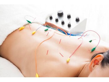 サロン ド ツリーズ(Salon de Trees)/筋肉を動かして緩める鍼灸パルス