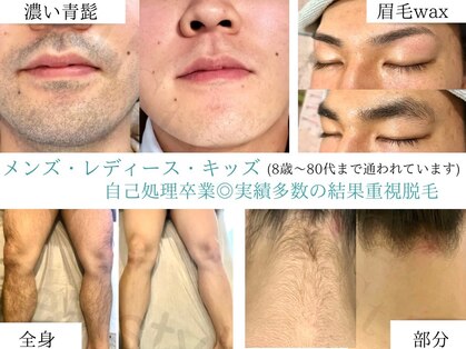 ベルスタイル(Bell style)の写真