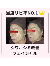 シン(Shin)/【シワ、シミ改善フェイシャル】