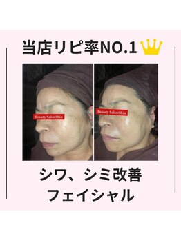 シン(Shin)/【シワ、シミ改善フェイシャル】