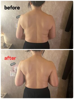 アコルデ(Acorde)/背中コルギで背中スッキリ美しく