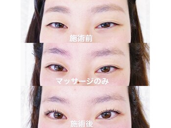 エニー 南流山店(eny)/ダブルアイリフト