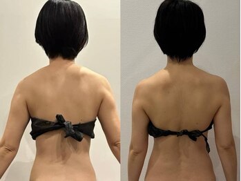 パリスヒロトン(PARIS HIROTON)/肩こり・背中のシルエット改善