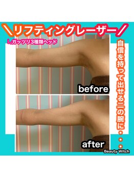 ビューティ ウィッチ(Beauty Witch)/気になる二の腕もお任せ下さい！