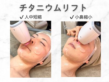 クレスト(CLEST.)/チタニウムリフトで人中短縮効果