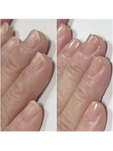 ギフト(GIFT)/自爪育成ネイルケア