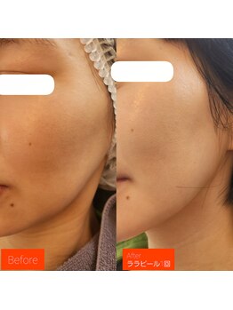 ビューティールームウィズ(beauty room w/)/ 肌を満たし艶肌水光肌へ