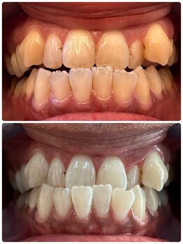 【医療提携】ホワイトニング専門店~Cinderella~/