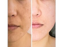 ジーニー(Genie)/「40代」からはお肌が名刺