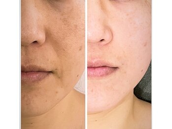 ジーニー(Genie)/「40代」からはお肌が名刺