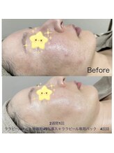 エクラ(eclat)/驚きの変化！