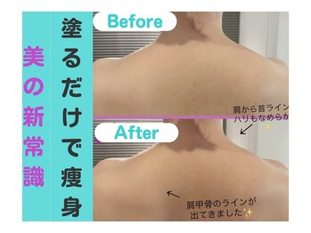 ナナ 銀座(Nana)/お家で塗るだけで痩身できる!