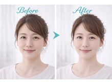 アプロ(Aphro)/花嫁フェイスケア