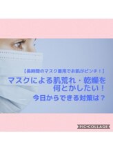 ベルビー エルエル岡崎店/マスクによる肌荒れ☆