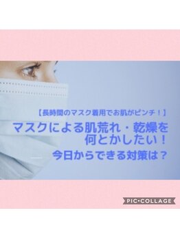 ベルビー エルエル岡崎店/マスクによる肌荒れ☆