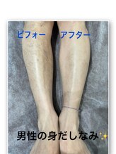 ビューティー アディクト(Beauty addict)/メンズ脱毛