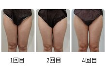 レスプロンディール(Resplendir)/内ももにすき間☆