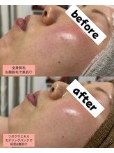 シロ(SHIRO)/褒められ肌