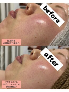 シロ(SHIRO)/褒められ肌