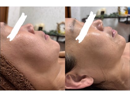 キレイになる路の写真