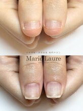 マリーロール 淀屋橋本店(Marie Laure)/深爪矯正/自爪育成/ネイルケア