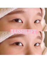 リンド エステ まつげ 京成大久保(Lind)/ラッシュリフト