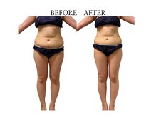 ヨサパーク サノン(YOSA PARK Sanon)/ よもぎ蒸し/痩身/リンパ