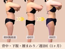 ヨサパーク ミューズ(YOSA PARK MUSE)の雰囲気（座るだけで脂肪燃焼を促進☆むくみもスッキリ◎）