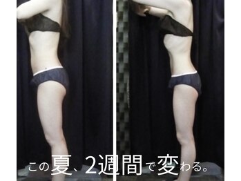 トリニティ 銀座店(TRINITY)の写真/スピード重視の方に◎全身痩身【オールハンド筋膜 &リンパ痩身★90分¥12800】劇的ボディメイクでダイエット