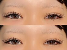 リジェネ(Regene)/LEDバインドロック120束