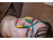 高田馬場はりきゅう院/鼻の症状への鍼灸